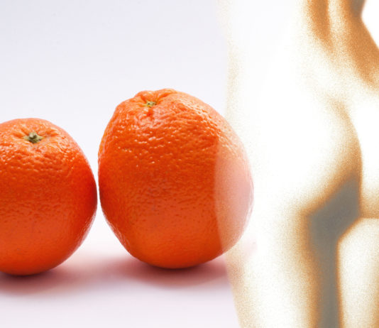 Mesoteràpia contra la cel·lulitis a Policlínic Simonet Reus